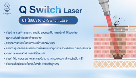 Q-SWITCH LASER | BE WELLNESS CLINIC